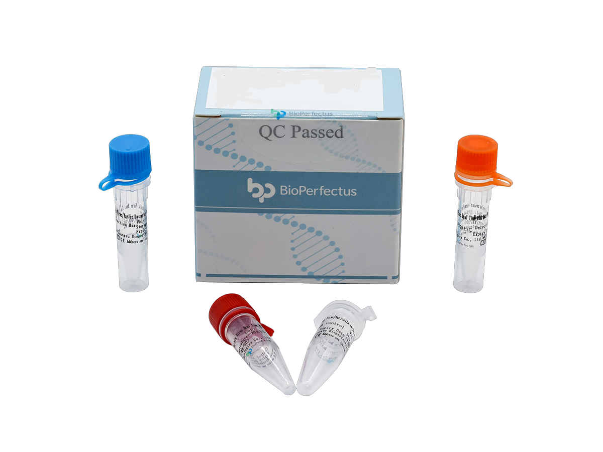 BioPerfectus Hantavirus Real Time PCR Kit