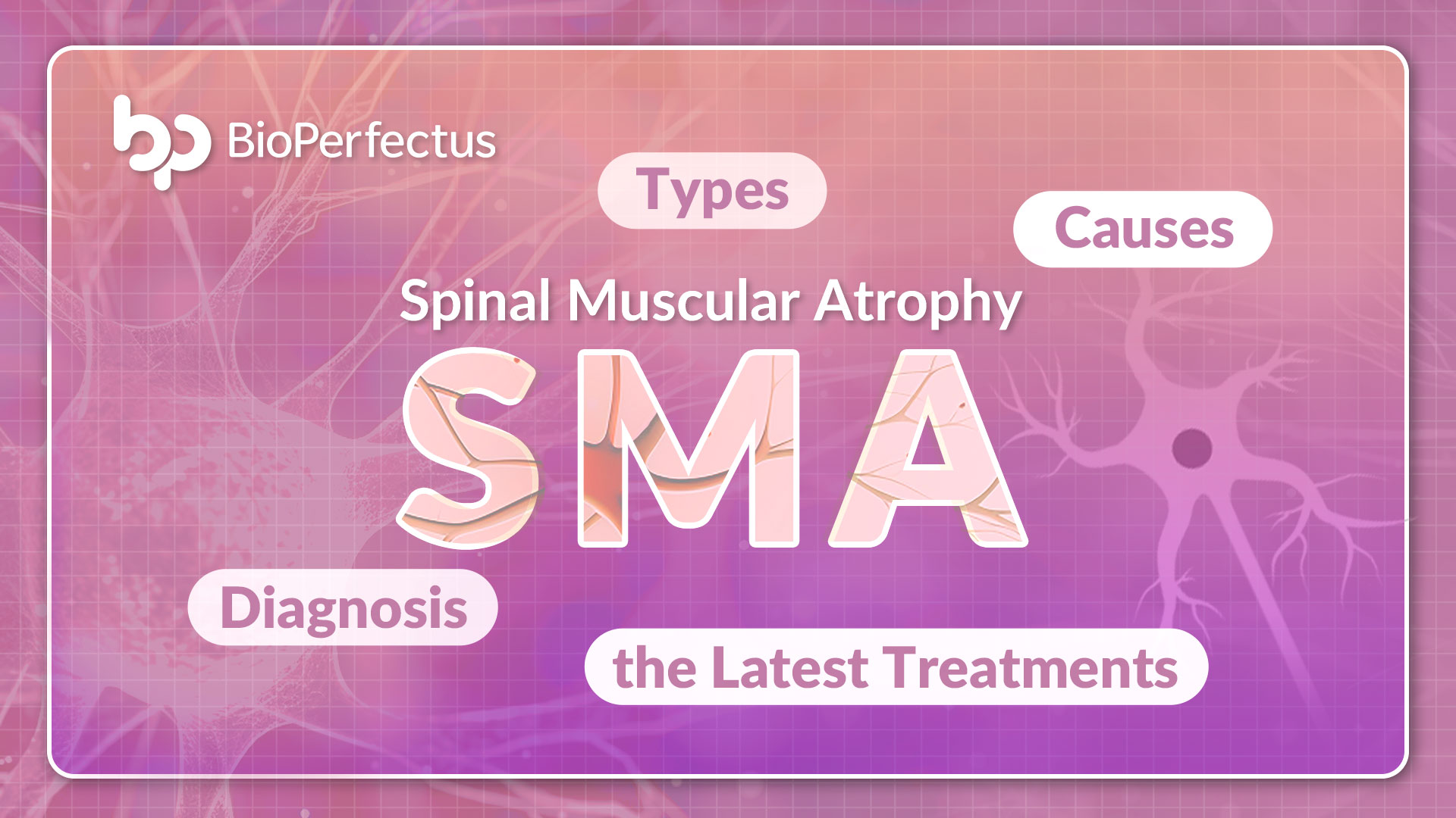 Spinal Muscular Atrophy (SMA) Causes, Types, Diagnosis, and the Latest Treatments
