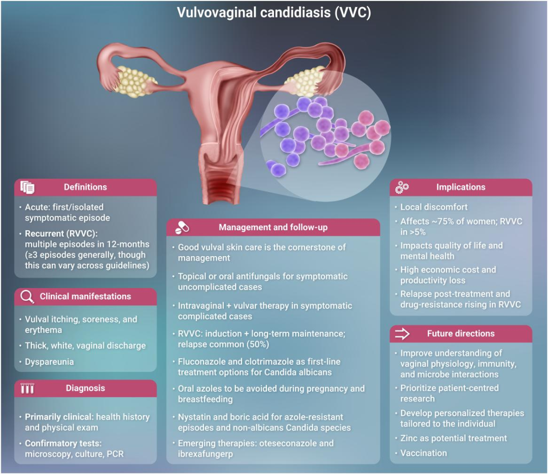 外阴阴道念珠菌病(VVC)领域的前沿进展综述