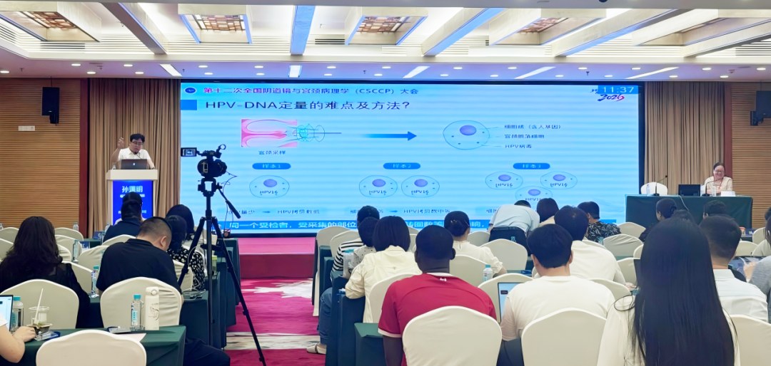 共识明确,基于实时荧光定量PCR及细胞数量校正的标准化定量技术,克服采样偏差对HPV载量检测的影响,可真实地反映患者HPV载量水平,推荐其应用于HPV载量检测。